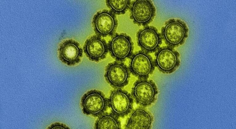 Bauru identifica casos positivos de Influenza H3N2