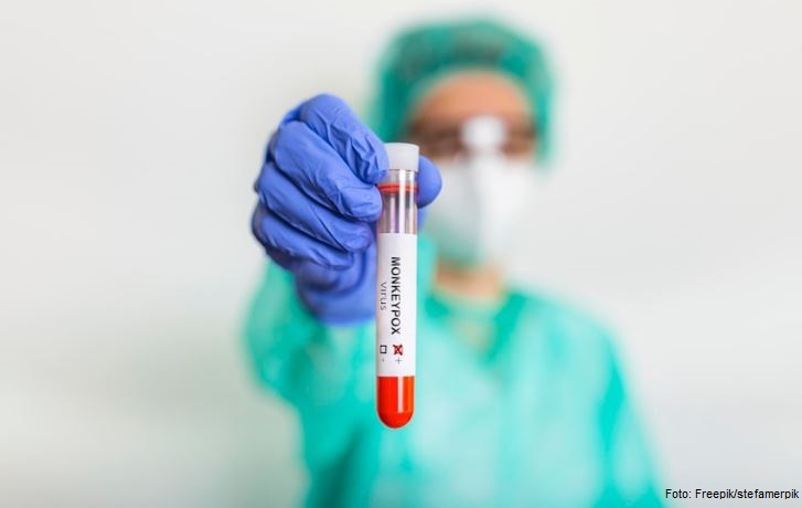 Ministério da Saúde confirma 1ª morte relacionada à varíola dos macacos