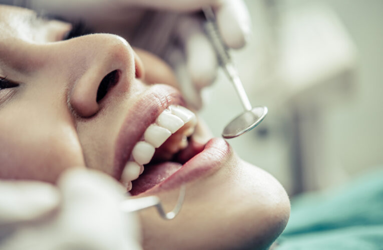 ‘Coroas’: USP seleciona pacientes voluntários para pesquisa em dentística